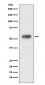 Anti-Retinoic Acid Receptor alpha RARA Rabbit Monoclonal Antibody