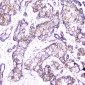 Anti-beta Catenin CTNNB1 Antibody Picoband™ (monoclonal, 1F6)