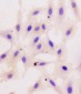 Anti-beta Catenin CTNNB1 Antibody Picoband™ (monoclonal, 1F6)