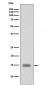 Anti-Phospho-Histone H3 (S10) HIST1H3A Rabbit Monoclonal Antibody