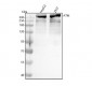 Anti-ATM Monoclonal Antibody