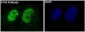 Anti-ATM Monoclonal Antibody