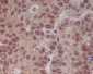 Anti-p16 INK Monoclonal Antibody