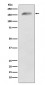 Anti-APC Monoclonal Antibody