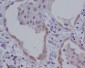 Anti-NALP3 NLRP3 Rabbit Monoclonal Antibody