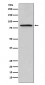 Anti-Periostin Monoclonal Antibody