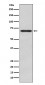 Anti-Glypican 3 Monoclonal Antibody