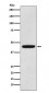 Anti-PDK1 Monoclonal Antibody