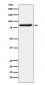 Anti-Bag3 Monoclonal Antibody