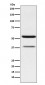 Anti-CEACAM6 Rabbit Monoclonal Antibody