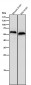 Anti-CEACAM6 Rabbit Monoclonal Antibody