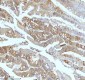 Anti-Ferritin Light Chain FTL Monoclonal Antibody