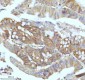 Anti-Ferritin Light Chain FTL Monoclonal Antibody