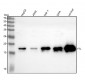 Anti-Ferritin Light Chain FTL Monoclonal Antibody