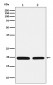 Anti-Ferritin Light Chain FTL Monoclonal Antibody