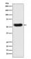 Anti-SERPINC1 Monoclonal Antibody