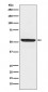 Anti-SPHK1 Monoclonal Antibody