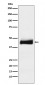 Anti-ORM1 Monoclonal Antibody