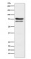 Anti-PKC epsilon Monoclonal Antibody