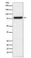 Anti-KLKB1 Monoclonal Antibody