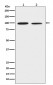 Anti-DDR2 Monoclonal Antibody