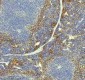 Anti-PF4 Monoclonal Antibody