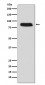 Anti-GCSF Receptor (CD114) Monoclonal Antibody