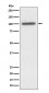 Anti-alpha Actinin 4 ACTN4 Monoclonal Antibody