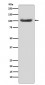 Anti-MSH2 Monoclonal Antibody