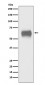 Anti-CD5 Monoclonal Antibody