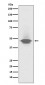 Anti-CD79a Monoclonal Antibody