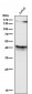 Anti-CD79a Monoclonal Antibody