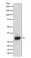 Anti-Calretinin Monoclonal Antibody