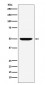 Anti-MUM1 Monoclonal Antibody