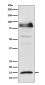 Anti-ISG15 Monoclonal Antibody