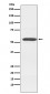 Anti-Cytochrome P450 2D6 CYP2D6 Monoclonal Antibody