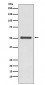 Anti-LOXL2 Rabbit Monoclonal Antibody