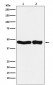 Anti-UQCRC2 Monoclonal Antibody