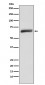 Anti-USP22 Monoclonal Antibody