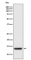 Anti-TAX1BP3 Monoclonal Antibody