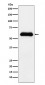 Anti-alpha 1 Antichymotrypsin SERPINA3 Monoclonal Antibody