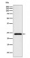 Anti-Mad2L2 Monoclonal Antibody