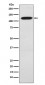 Anti-Ctip1 Monoclonal Antibody