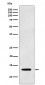 Anti-Galectin 1 LGALS1 Monoclonal Antibody