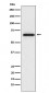 Anti-MMP2 Monoclonal Antibody