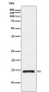 Anti-ANP NPPA Monoclonal Antibody