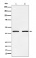 Anti-SMYD3 Monoclonal Antibody