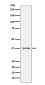 Anti-CD23 FCER2 Monoclonal Antibody