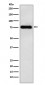 Anti-LYRIC Monoclonal Antibody