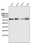 Anti-PFKFB3 Monoclonal Antibody